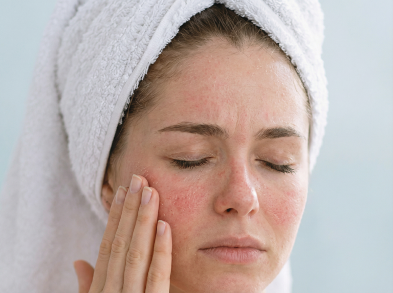 Preťažená pleť: prečo viac produktov nerovná sa lepšia starostlivosť skin burnout